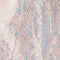 Pink Multi